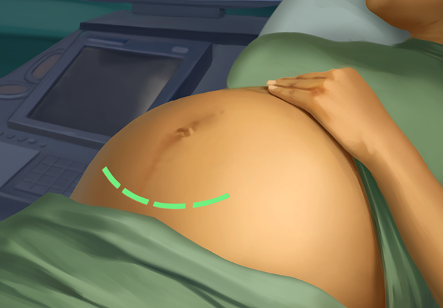 Operate Now: Hospital Resimleri