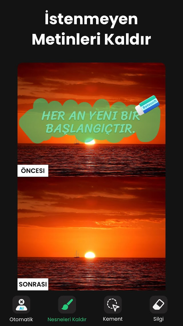 Nesne Silme & Nesne Kaldırma Resimleri