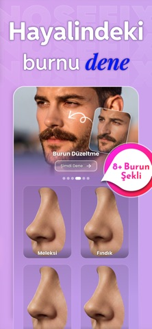 Burun D�zeltme AI: Nosefix Resimleri