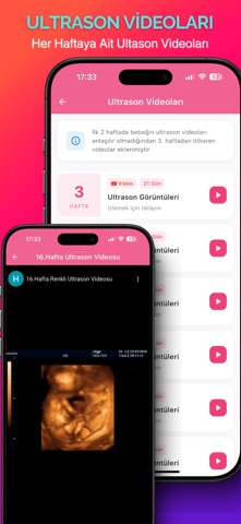 G�n G�n Gebelik Takibim Resimleri