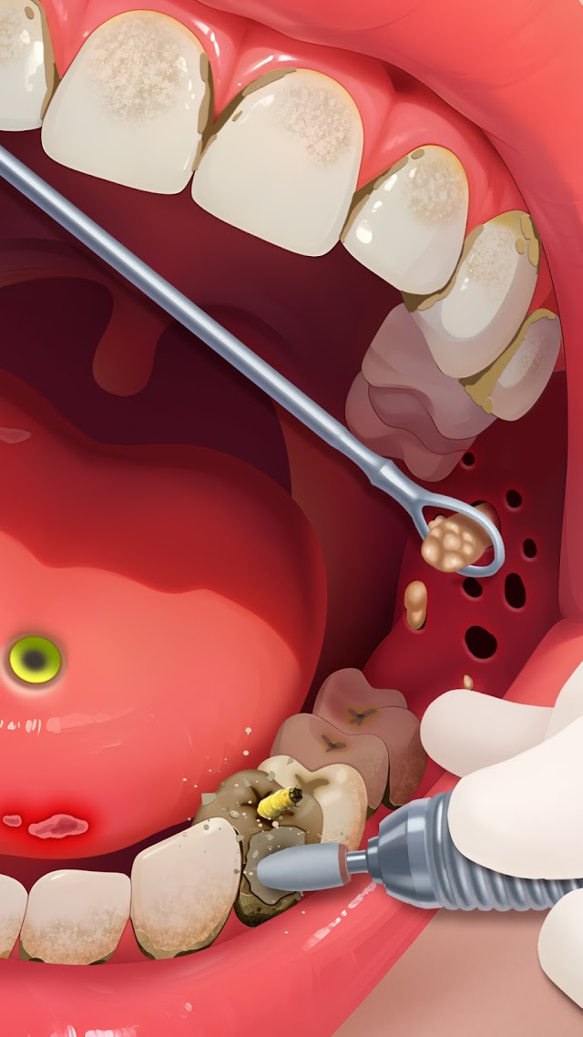 Screw Project: ASMR Home Resimleri