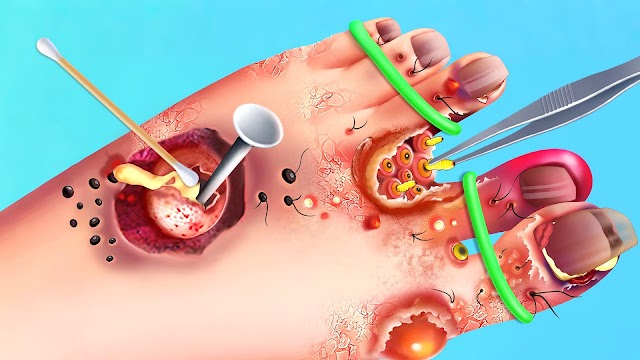 Screw Project: ASMR Home Resimleri