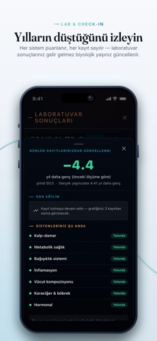 Longeva: Longevity Koçu Resimleri