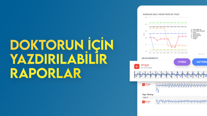 Anında kalp hızı monitörü Resimleri